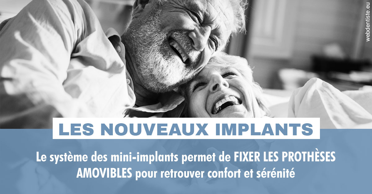https://dr-fortier-pierre.chirurgiens-dentistes.fr/Les nouveaux implants 2