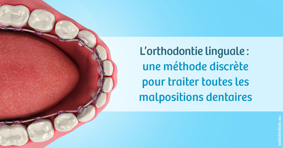 https://dr-fortier-pierre.chirurgiens-dentistes.fr/L'orthodontie linguale 1