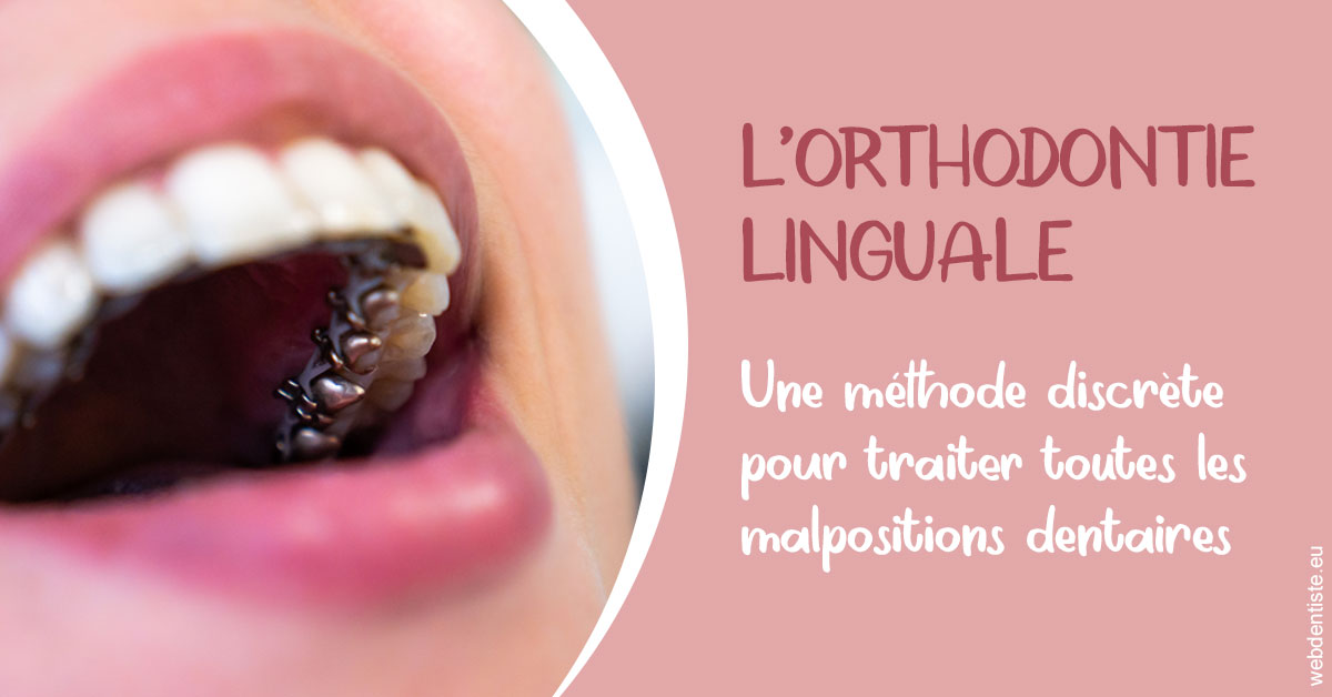 https://dr-fortier-pierre.chirurgiens-dentistes.fr/L'orthodontie linguale 2