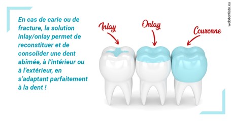 https://dr-fortier-pierre.chirurgiens-dentistes.fr/L'INLAY ou l'ONLAY