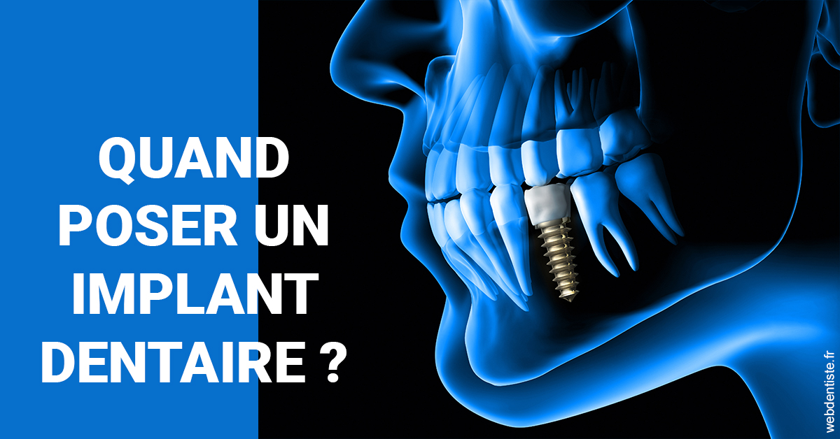 https://dr-fortier-pierre.chirurgiens-dentistes.fr/Les implants 1