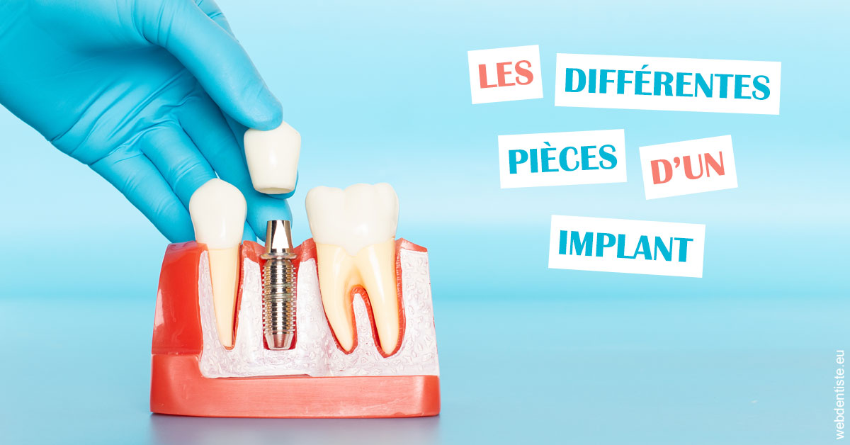 https://dr-fortier-pierre.chirurgiens-dentistes.fr/Les différentes pièces d’un implant 2