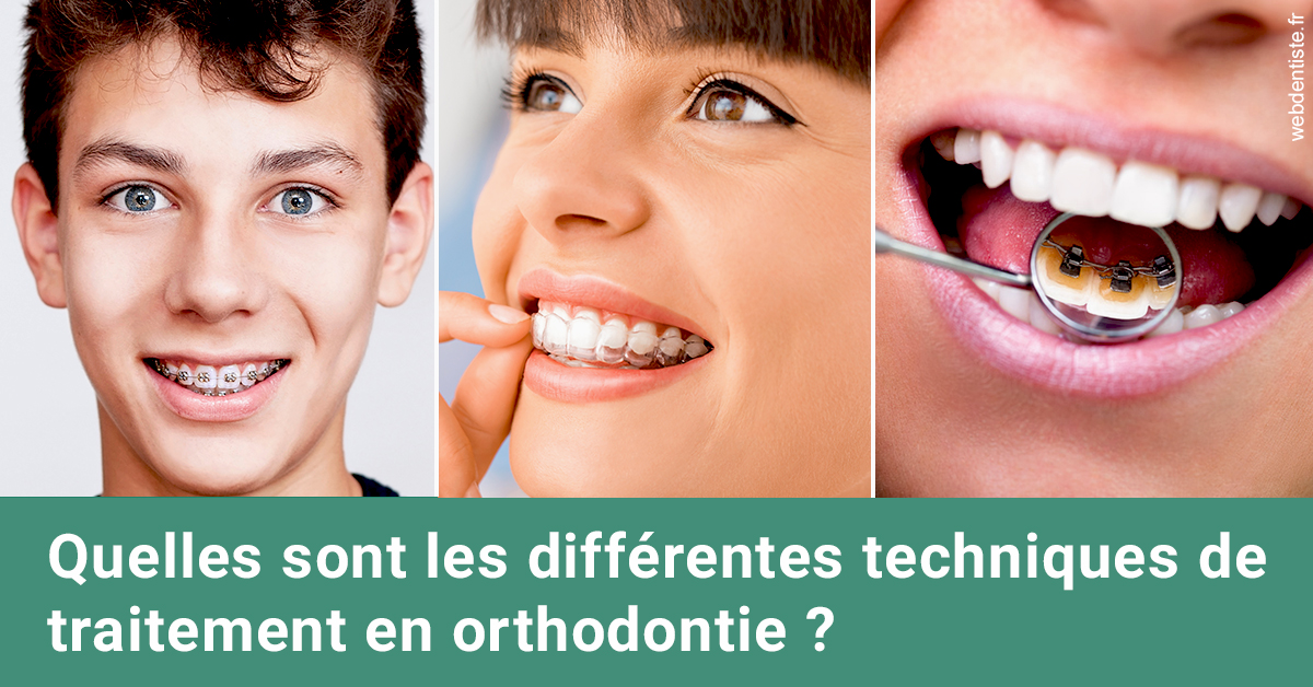 https://dr-fortier-pierre.chirurgiens-dentistes.fr/Les différentes techniques de traitement 2