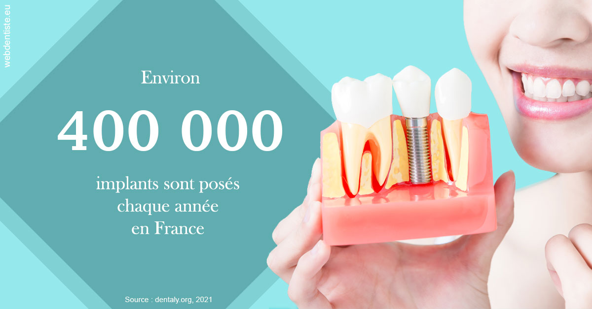 https://dr-fortier-pierre.chirurgiens-dentistes.fr/Pose d'implants en France 2