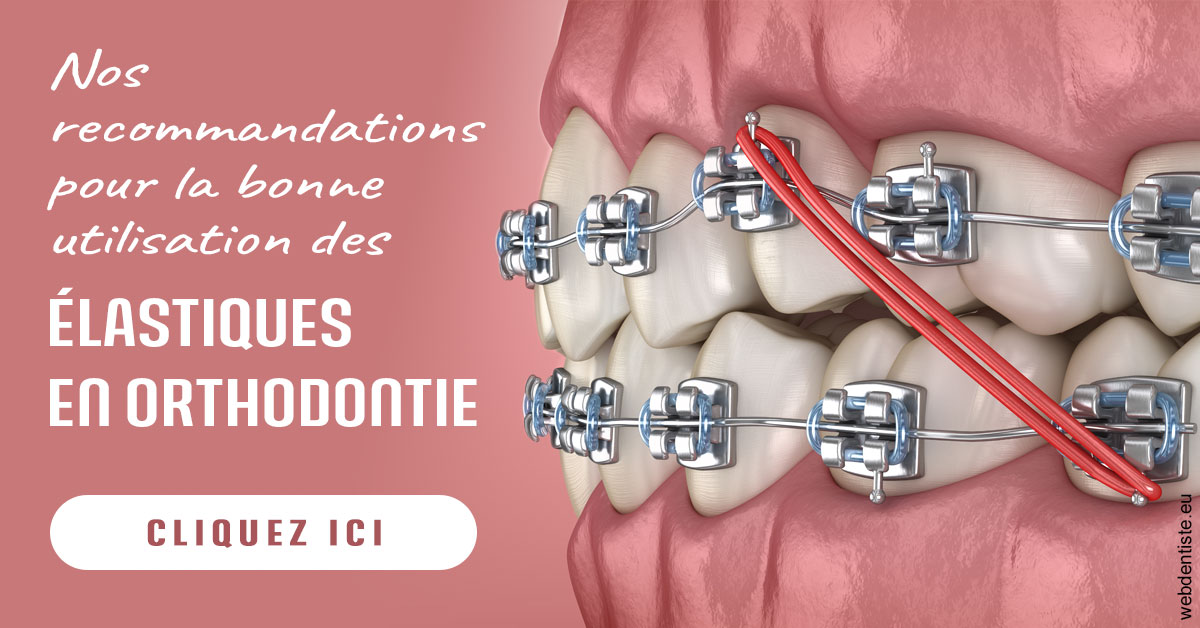 https://dr-fortier-pierre.chirurgiens-dentistes.fr/Elastiques orthodontie 2